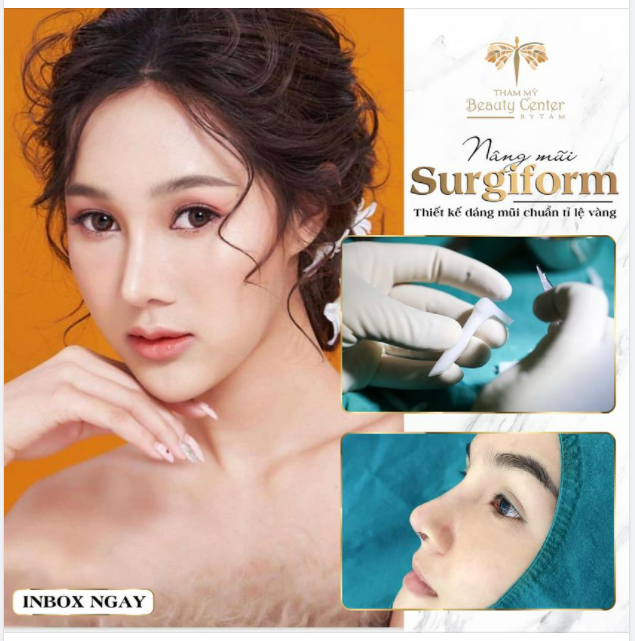 Nâng mũi Surgiform-Nâng thần thái-Đẹp hài hòa