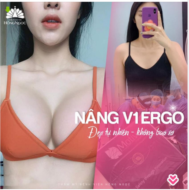 NÂNG V1 ERGONOMIX: ĐẸP TỰ NHIÊN - KHÔNG BAO XƠ