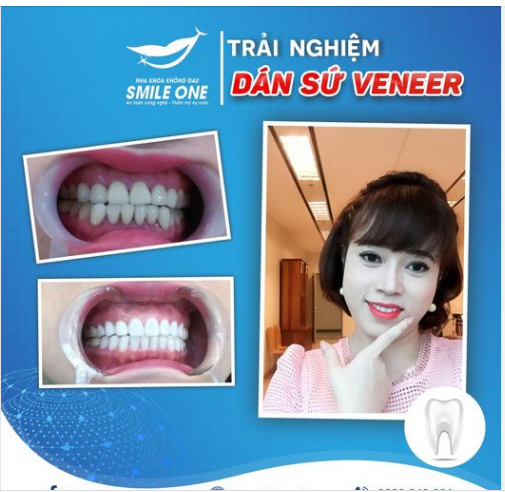 " Nếu khoảng cách giữa em và một nụ cười đẹp là một nghìn bước