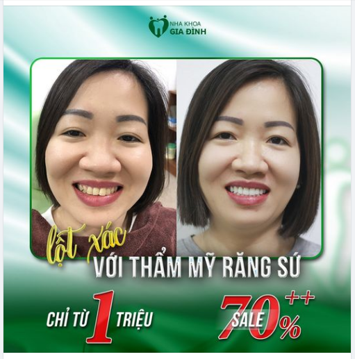 NẾU KHÔNG THỬ THÌ SAO TA BIẾT RĂNG MÌNH CÓ NGÀY ĐƯỢC ĐẸP NHƯ THẾ NÀY