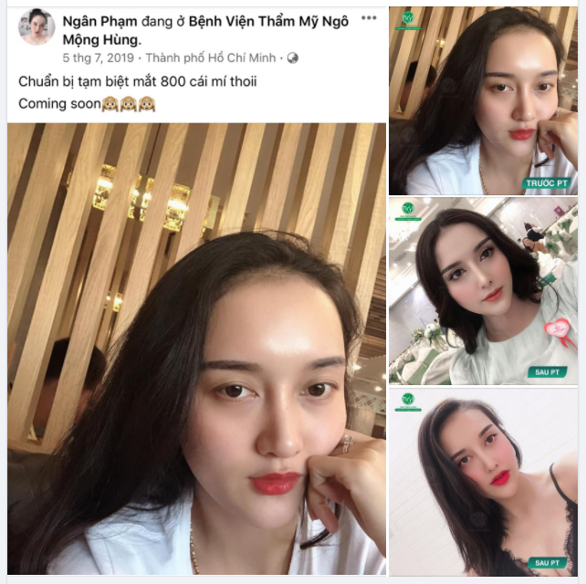 NGÀY ẤY -  BÂY GIỜ Cô nàng Ngân Phạm thay đổi hoàn toàn sau cắt mí