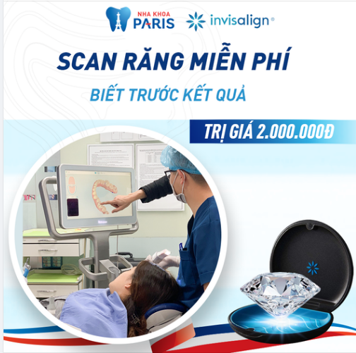 NGÀY HỘI SCAN RĂNG ITERO 5D MIỄN PHÍ
