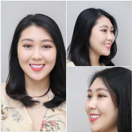 NGHE NÓI BẠN THÍCH HÀM RĂNG ĐẸP