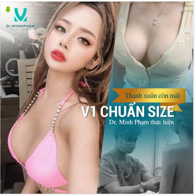 NGỰC ĐẸP NHƯ MƠ SAU 1 GIỜ NÂNG CẤP