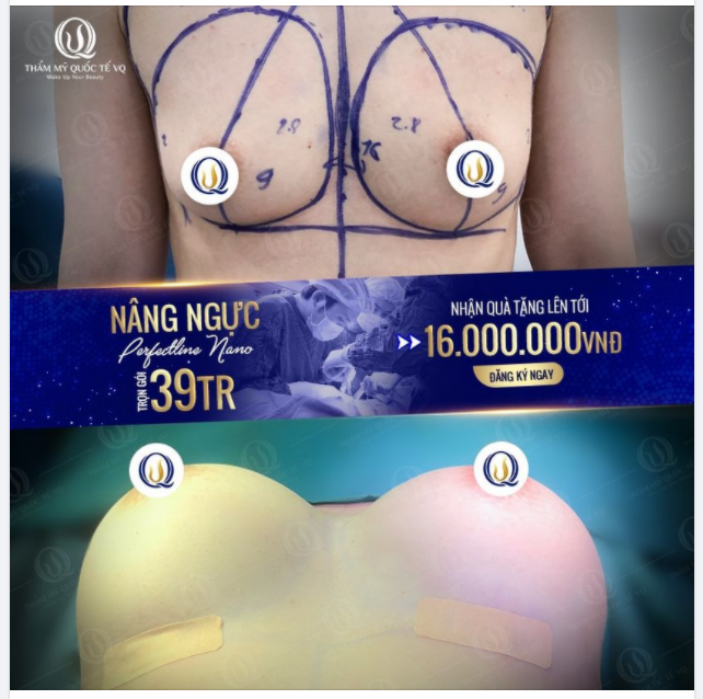 Ngựcc không có vẫn có thể cứu vãn được !