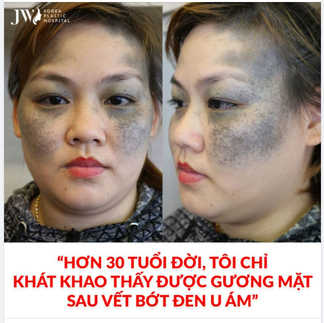 NGƯỜI GIÀ BẢO KIẾP TRƯỚC GẶP NẠN VỚI LỬA TRẺ NHỎ VÍ NGƯỜI DƠI, BATMAN NGOÀI ĐỜI