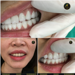 Người phụ nữ ghé qua Nha Khoa Khoa Phương Anh