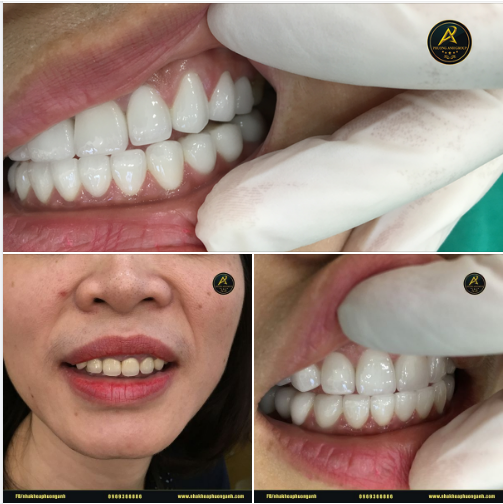 Người phụ nữ ghé qua Nha Khoa Khoa Phương Anh