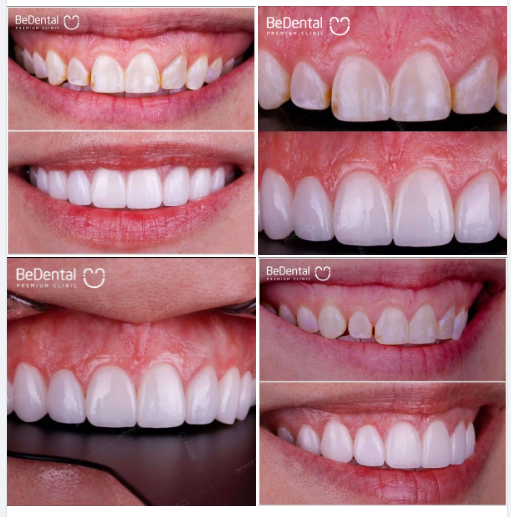 Người ta nói, đầu tư cho bản thân luôn là loại đầu tư có lời nhất