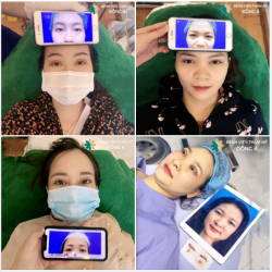 Nhá hình 1 vài siêu phẩm được tạo nên bởi Công nghệ Cắt mí Natural Eyes và đội ngũ Bác sĩ dày dặn kinh nghiệm thuộc Hiệp hội Thẩm mỹ Hàn Quốc.