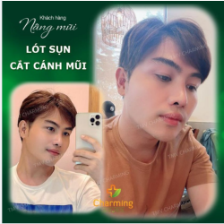 Nhận feedback của anh chàng xong mà tim Charming đã rụng rời không nói nên lời vì chiếc mũi quá ư là xuất sắc luôn