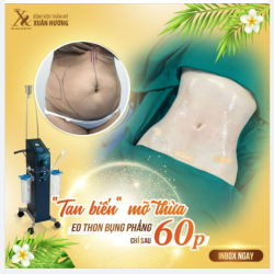 NHANH TAY DỌN SẠCH MỠ CÙNG “DŨNG SĨ DIỆT MỠ - S SHAPE BODY JET”