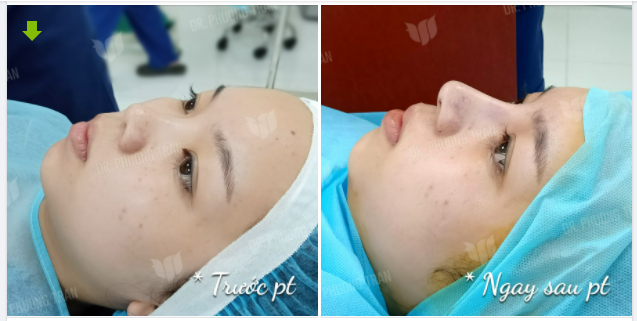 NHẸ NHÀNG THÔI NHƯNG ĐỦ KHÁC BIỆT