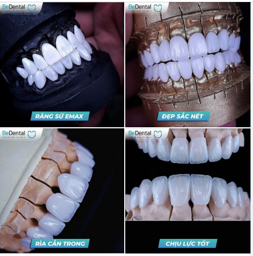 NHÌN KHUÔN RĂNG ĐẸP THẾ NÀY MÀ SAO CÒN CHÂN CHỪ