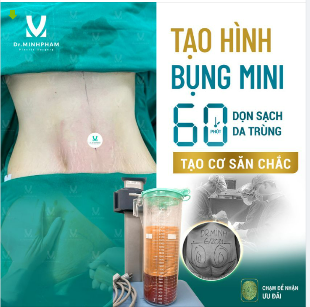 NHÌN LÀ PHÊ – LÀM LÀ MÊ COMBO HÚT MỠ + TẠO HÌNH BỤNG MINI chưa bao giờ hết HOT