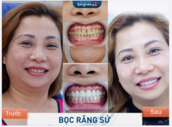 Nhìn vào khách hàng thôi là đã biết công nghệ Kangnam thế nào rồi
