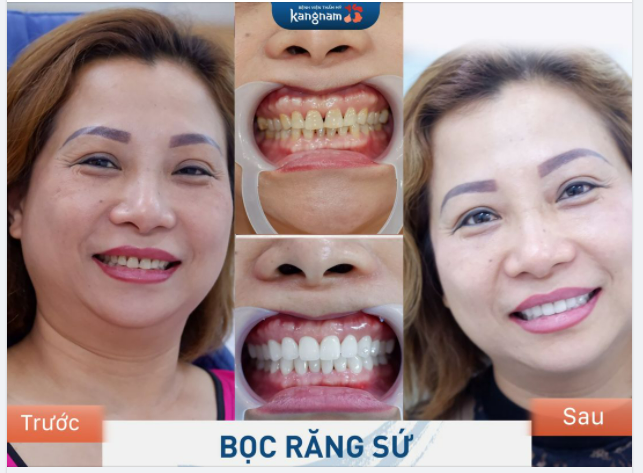 Nhìn vào khách hàng thôi là đã biết công nghệ Kangnam thế nào rồi