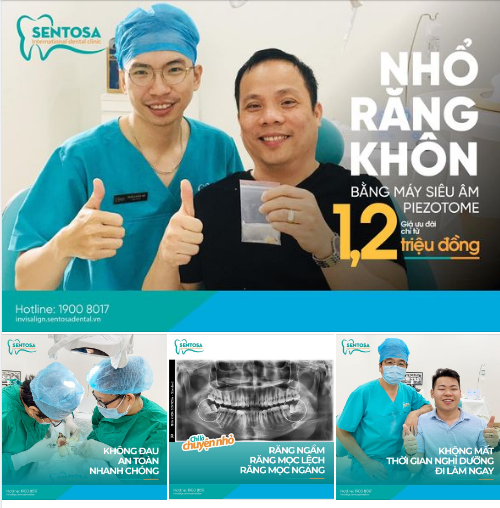 Nhổ Răng 8  Bằng Máy Siêu Âm Piezotome Công Nghệ hiện đại nhất hiện nay