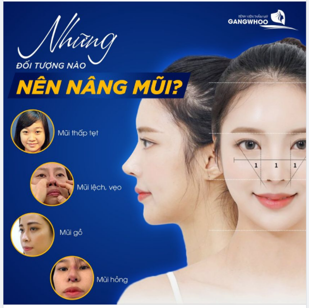 NHỮNG ĐỐI TƯỢNG NÀO NÊN NÂNG MŨI