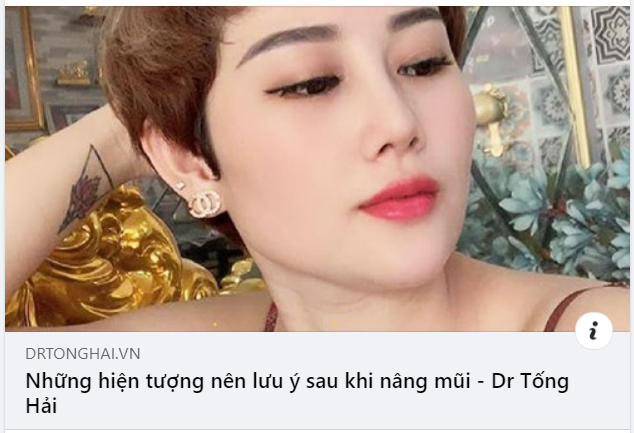 NHỮNG HIỆN TƯỢNG ĐƯỢC COI LÀ BÌNH THƯỜNG/ BẤT THƯỜNG SAU KHI NÂNG MŨI