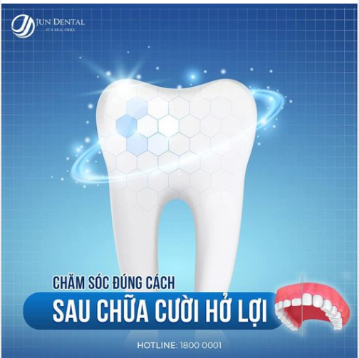 NHỮNG LƯU Ý VỀ CHẾ ĐỘ CHĂM SÓC SAU KHI ĐIỀU TRỊ CƯỜI HỞ LỢI