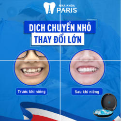 NIỀNG RĂNG INVISALIGN  BÍ KÍP CƯỜI XINH - LUNG LINH ĐÓN HÈ
