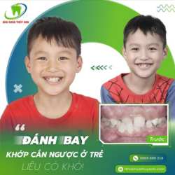 NIỀNG RĂNG SỚM CHO TRẺ - THỜI ĐIỂM VÀNG CHO NỤ CƯỜI MỚI