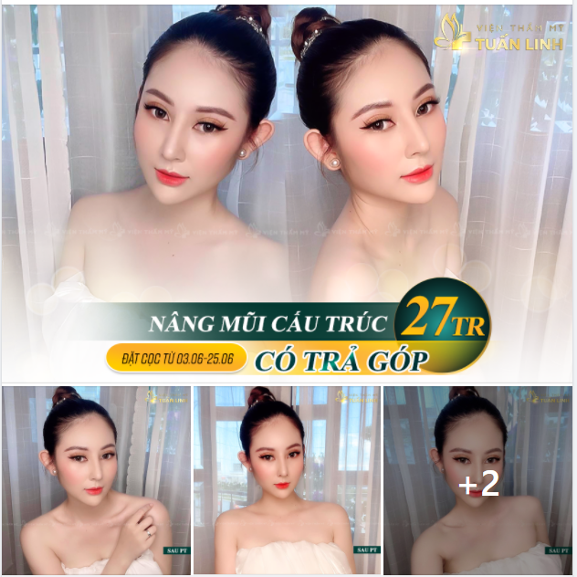 NỔ INBOX ẦM ẦM VÌ MŨI CẤU TRÚC CHỈ 27TRIỆU