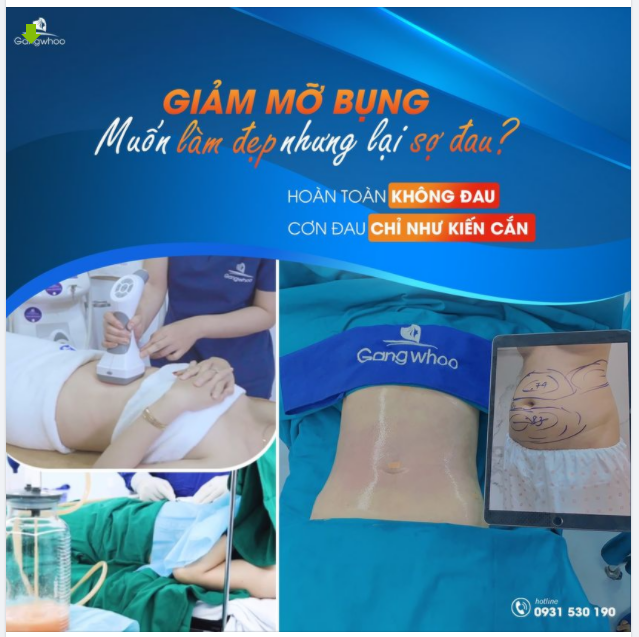 NỖI SỢ ĐAU – HÀNG RÀO CẢN TRỞ BẠN ĐẾN VỚI THẨM MỸ GIẢM MỠ