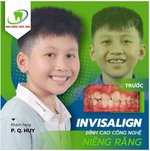 NỤ CƯỜI CỦA CON LÀ HẠNH PHÚC CỦA BA MẸ