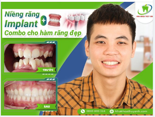 NỤ CƯỜI ĐẸP KHỞI ĐẦU CHO VẠN ĐIỀU MAY MẮN