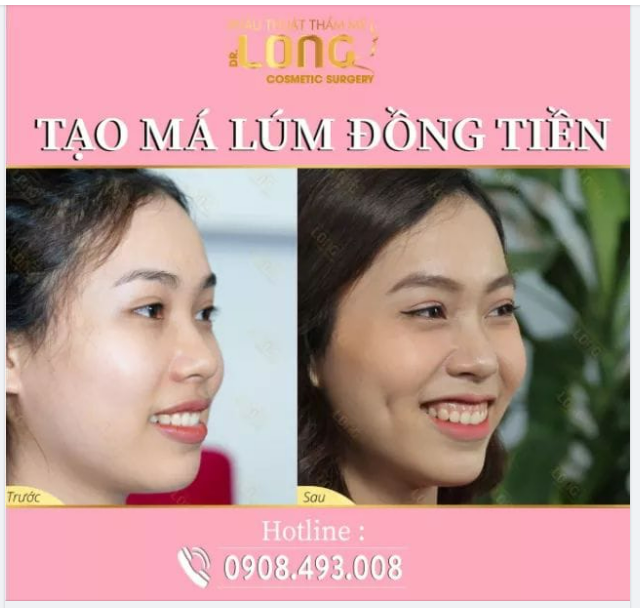 Ở ĐÂY CÓ BÁN NÉT “DUYÊN DÁNG, ĐÁNG YÊU” DÀNH CHO CÁC CÔ NÀNG ANH CHÀNG MANG VỀ