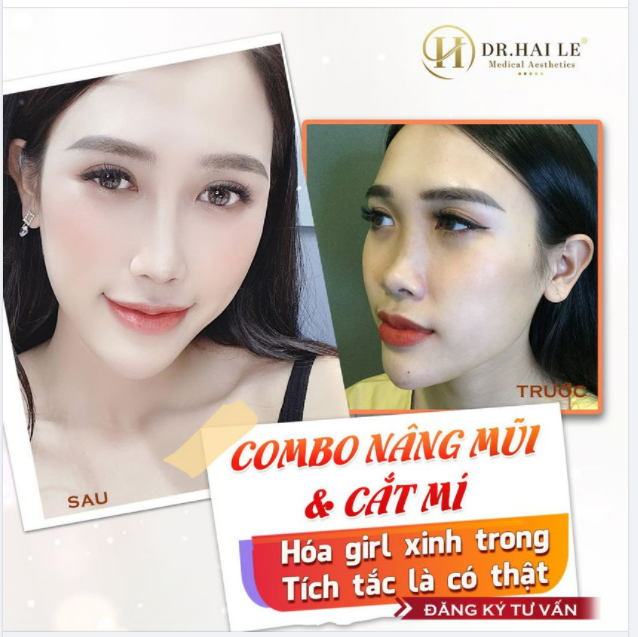 Ông trời tạo ra địa chấn và khuôn mặt em chính là điểm nhấn. Mắt đẹp, mũi sang thế này không yêu không được