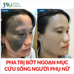 PHA TRỊ BỚT ĐỈNH CAO KÉO NGƯỜI PHỤ NỮ KHỎI VỰC THẲM CUỘC ĐỜI