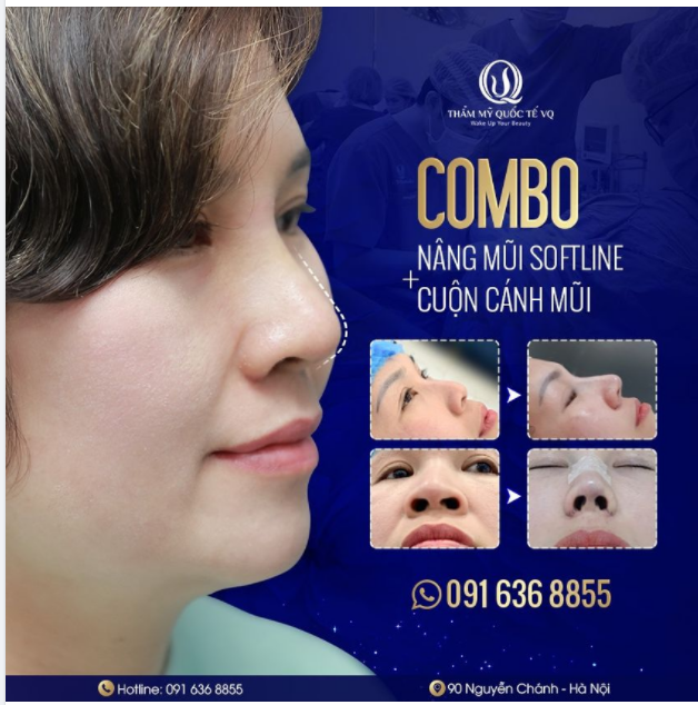 PHA XỬ LÝmũi tẹt + cánh mũi to bè "ĐI VÀO LÒNG NGƯỜI" CỦA BÁC SĨ VŨ QUANG