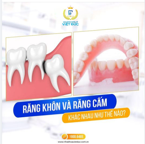 Phân biệt răng khôn và răng cấm