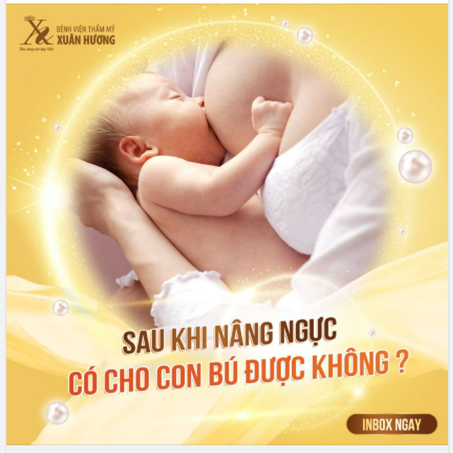 PHỤ NỮ KHI ĐÃ NÂNG NGỰC THÌ VỀ SAU SINH CON CÓ LÀM ẢNH HƯỞNG ĐẾN VIỆC CHO CON BÚ KHÔNG