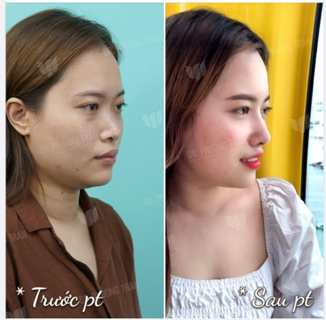 PHỤ NỮ PHẢI BIẾT YÊU THƯƠNG BẢN THÂN NHIỀU HƠN MỖI NGÀY