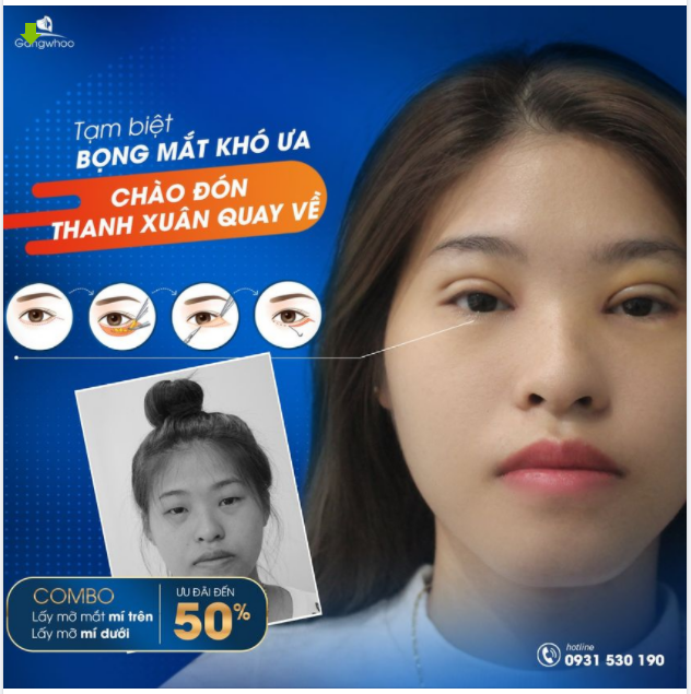 PHƯƠNG PHÁP TRẺ HOÁ “CỬA SỔ TÂM HỒN”