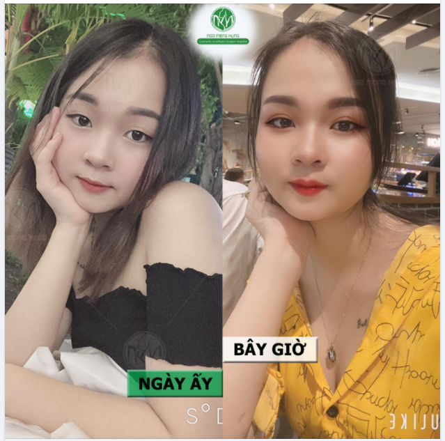 QUA RỒI CÁI THỜI ĐÔI MẮT MỘT MÍ KÉM XINH