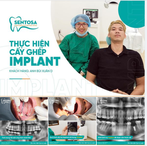 Quá trình điều trị bởi Bs Tường Linh chỉ cấy ghép trong vòng 30 phút, cực kì nhẹ nhàng và thoải mái sau khi kết thúc