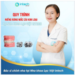QUY TRÌNH NIỀNG RĂNG MẮC CÀI KIM LOẠI TẠI NHA KHOA LẠC VIỆT INTECH