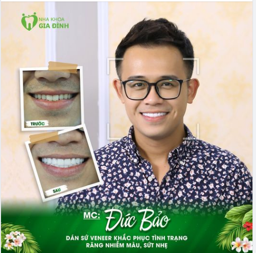 RĂNG ĐẸP CHÍNH LÀ BÍ QUYẾT NỤ CƯỜI TỰ TIN CỦA MC ĐỨC BẢO