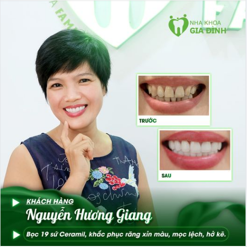 RĂNG ĐẸP CƯỜI XINH TỰ TIN KHOE SẮC