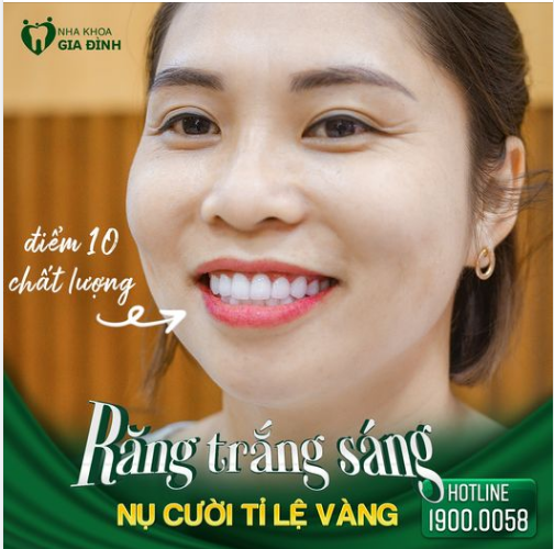 RĂNG ĐẸP KHÔNG TÌ VẾT – NỤ CƯỜI HOÀN MỸ CỰC SANG