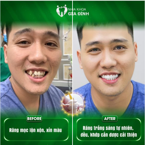 RĂNG ĐẸP THẾ NÀY THÌ PHẢI ĐI LÀM NGAY THÔI!