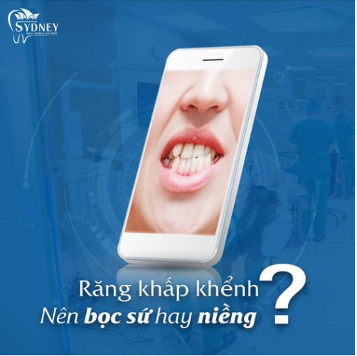 RĂNG KHẤP KHỂNH NÊN NIỀNG HAY BỌC SỨ