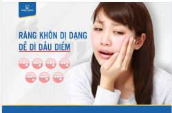 RĂNG KHÔN DỊ DẠNG DỄ GÌ GIẤU DIẾM