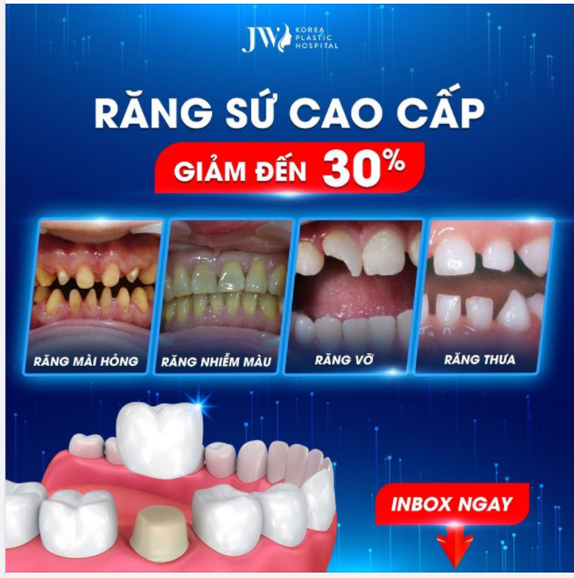 Răng sứ CAO CẤP - giá TỐT ĐẲNG CẤP