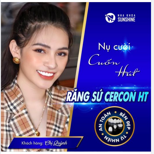 RĂNG SỨ CERCON HT – LỰA CHỌN LÝ TƯỞNG TRONG THẨM MỸ RĂNG SỨ